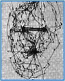 Mondveroudering: zo vermindert u rimpels en l