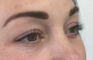 Veelgestelde vragen over een onderooglidcorrectie beantwoord - Prof. Aesthetics - Prof. Dr. Berend van der Lei