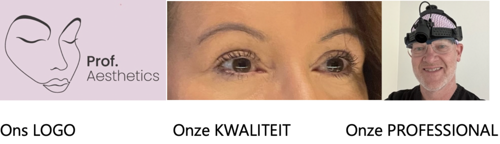 Ooglidcorrectie bij Prof. Aesthetics in Haren