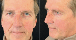 De sleutel tot een frisse, jeugdige uitstrali